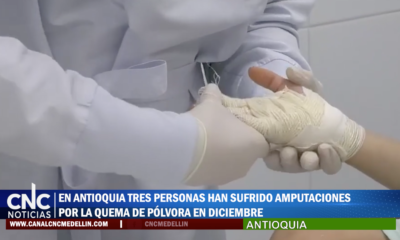 En Antioquia Tres Personas Han Sufrido Amputaciones Por La Quema De Pólvora En Diciembre