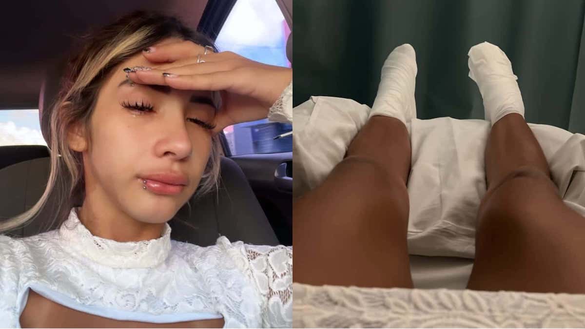 Desafío helado, influencer al borde de perder sus pies por reto viral